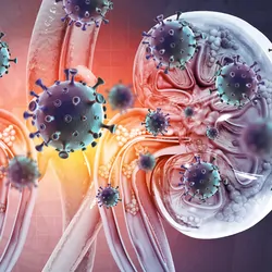 Computer image of kidney disease around kidneys