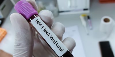 Gloved hand holding a blood sample labeled with HIV-1 