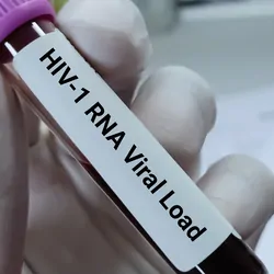 Gloved hand holding a blood sample labeled with HIV-1