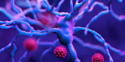 Computer image of COVID virus damaging neurons