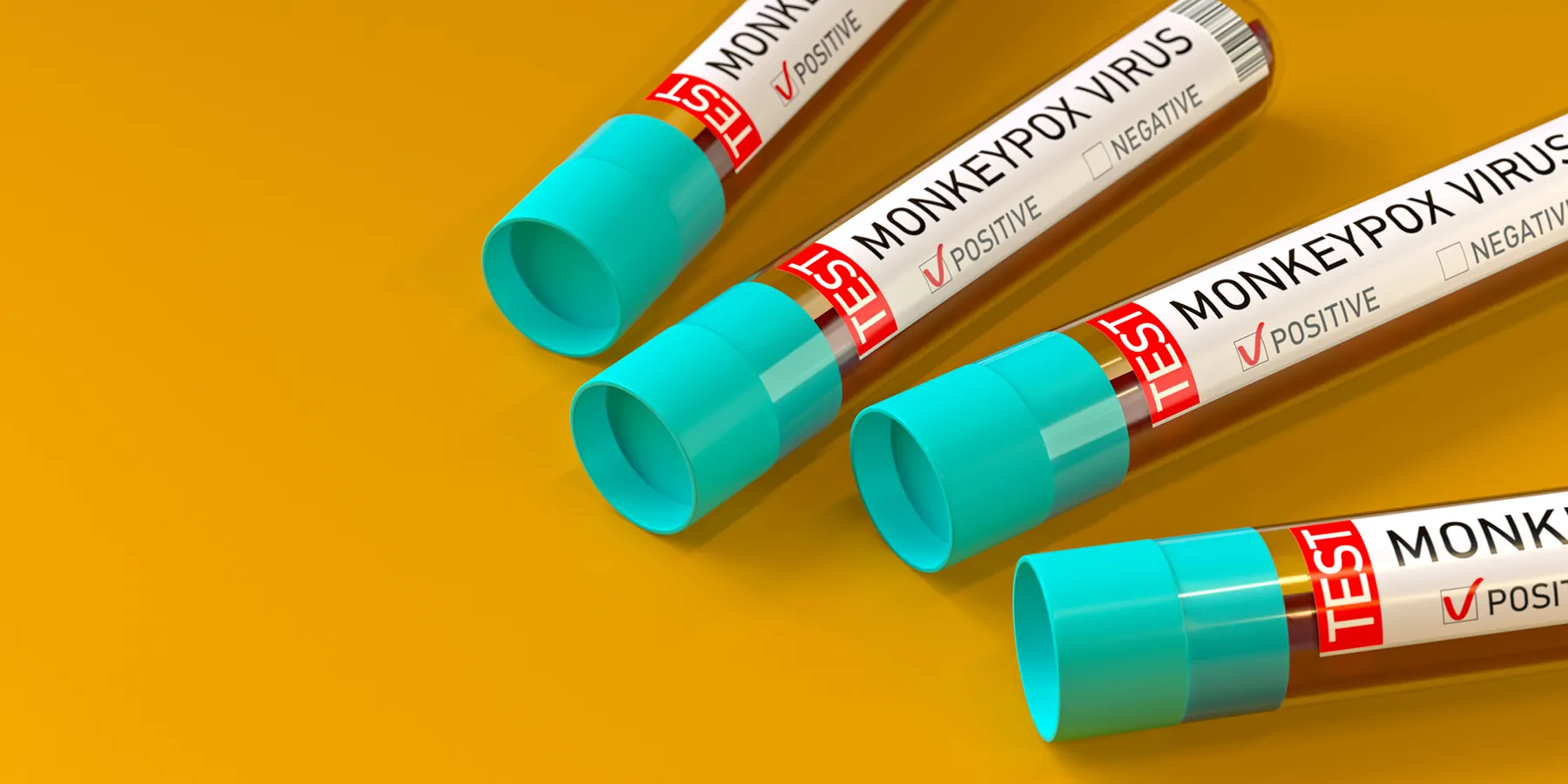 Four blood vials marked monkeypox positive