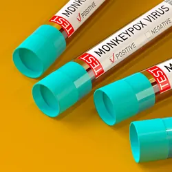 Four blood vials marked monkeypox positive