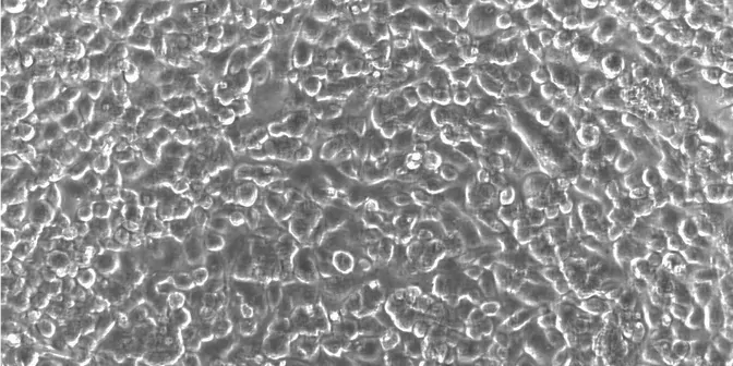 Cells cultured in a CytoView-Z plate.