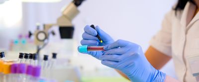 Person wearing blue gloves and short sleeved white lab coat writes with a felt pen on a blood tube with tubes and a microscope in the background.