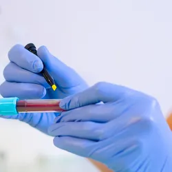 Person wearing blue gloves and short sleeved white lab coat writes with a felt pen on a blood tube with tubes and a microscope in the background.
