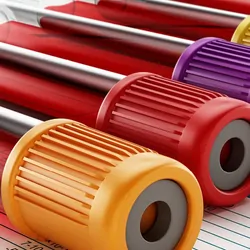 Several vials blood drawn for testing