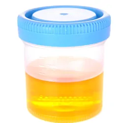 Urine cup with urine in it on a white background