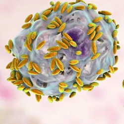Illustration of microscopic diagnosis of bacterial vaginosis.