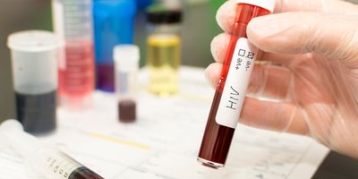 Lab technician holding blood vial marked HIV negative