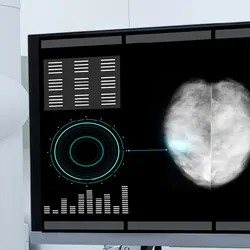 Mammogram machine with readout