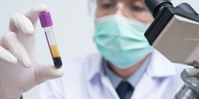 Scientist analyzing sample