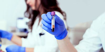 Lab tech wearing gloves, holding a vial of blood for testing