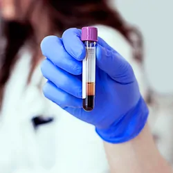 Lab tech wearing gloves, holding a vial of blood for testing