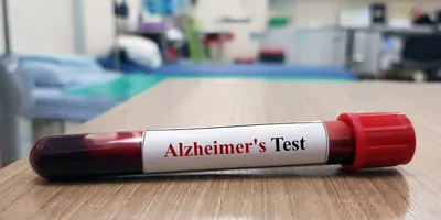 Blood vial resting on table, labled for Alzheimer's testing