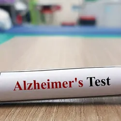 Blood vial resting on table, labled for Alzheimer's testing