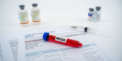 Table with blood collection tube labled "mpox", syringe and medication, and test results