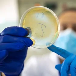 Two biologists examining a petri dish experiment