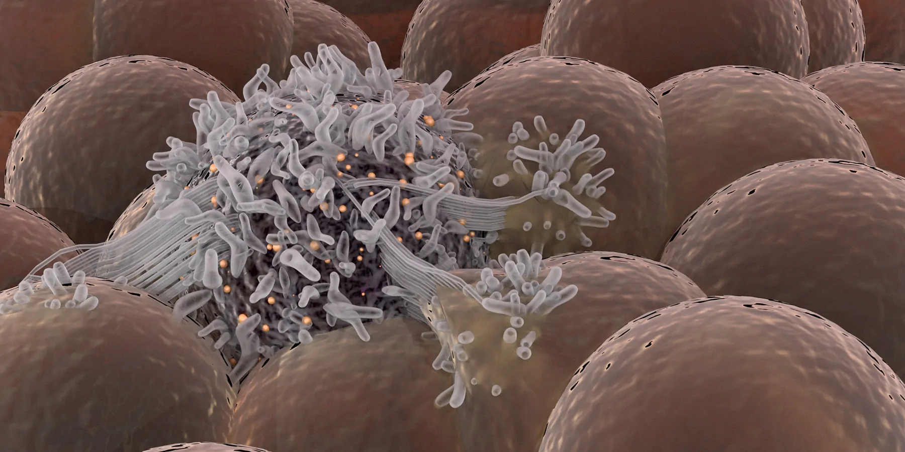 Computer image of cancer spreading among healthy cells