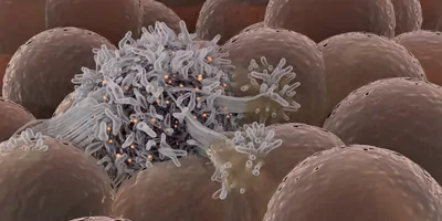 Computer image of cancer spreading among healthy cells
