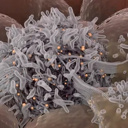 Computer image of cancer spreading among healthy cells