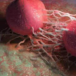 Computer image of malignant cancer cells