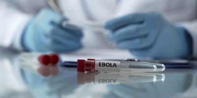 Researcher with test tubes labeled "Ebola"