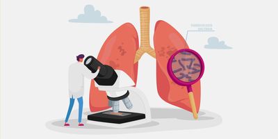 Vector graphic of a researcher with a large microscope and a pair of human lungs infected with TB