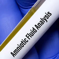 A tube with amniotic fluid for analysis