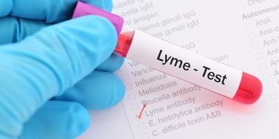 Gloved hand holding a blood sample for a Lyme disease test