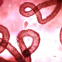 Microscopic image of ebola in blood
