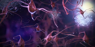 Computer image of damaged neurons