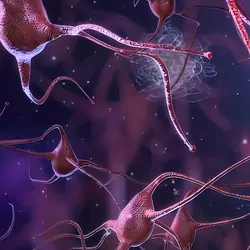 Computer image of damaged neurons