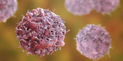 Computer image of cancerous cells in a medium