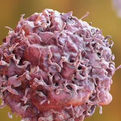 Computer image of cancerous cells in a medium