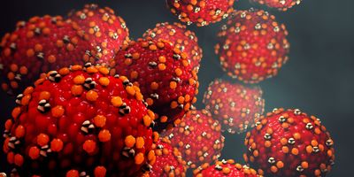 Computer images of measles viruse on a dark background