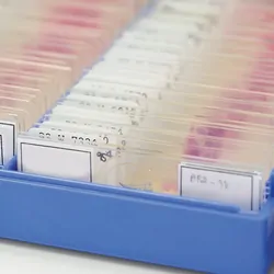 Photo of a box full of breast cancer biopsy slides.