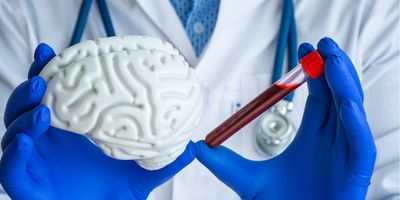 A pair of gloved hands hold a laboratory test tube with blood in one and a model of human brain in another.