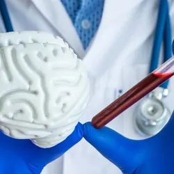 A pair of gloved hands hold a laboratory test tube with blood in one and a model of human brain in another.