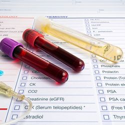 Tubes of blood and urine of a patient with a test report for analysis in the background.