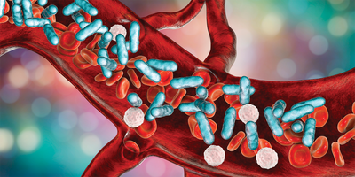 Speeding Up Sepsis Detection
