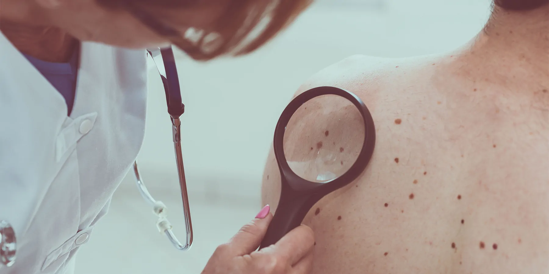 Dermatologist examining spots or moles on the back of a patient
