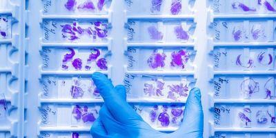 A gloved hand sorting histology slides