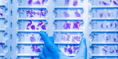 A gloved hand sorting histology slides