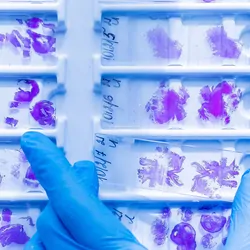 A gloved hand sorting histology slides