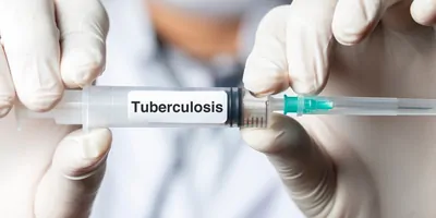 Close-up of a pair of gloved hands holding a syringe with Tuberculosis written.