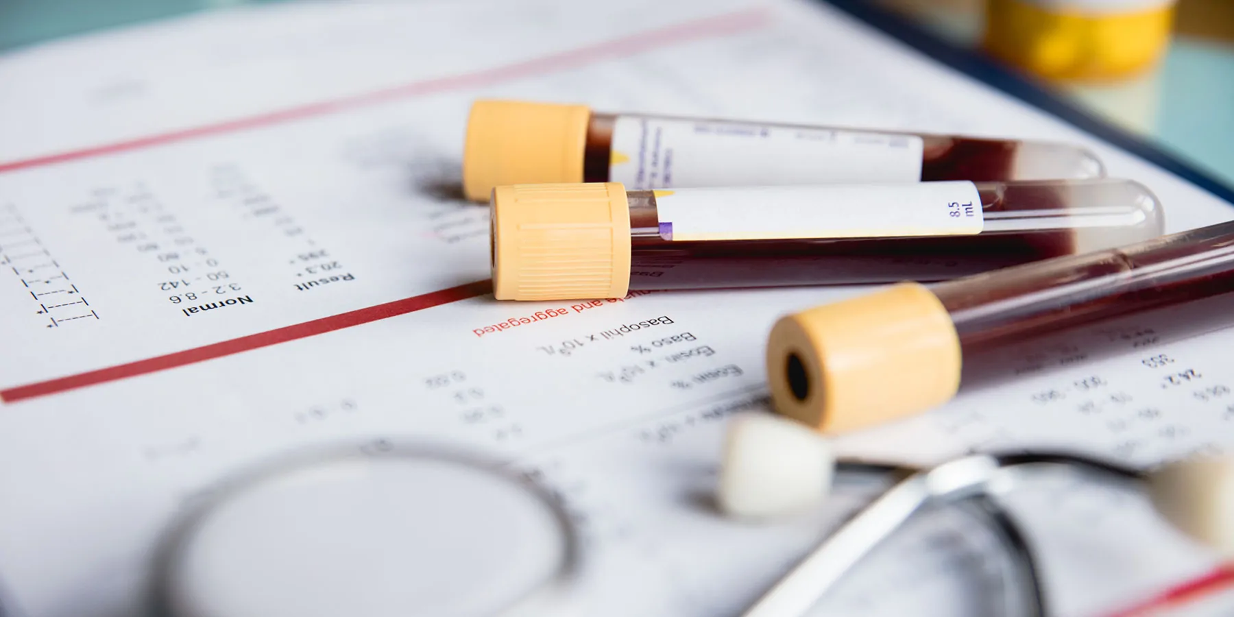 Close-up of three vacutainers containing blood samples on a test requisition form beside a stethescope