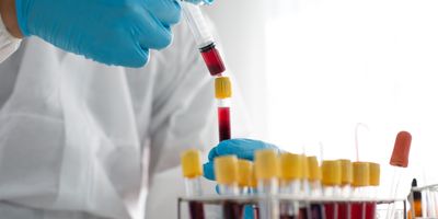 A clinician draws red fluid into a syringe from a series of vacutainers with blood samples.