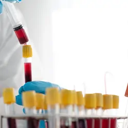 A clinician draws red fluid into a syringe from a series of vacutainers with blood samples.