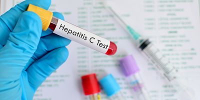 Close-up of a gloved hand holding a tube with blood sample for hepatitis C virus testing