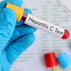 Close-up of a gloved hand holding a tube with blood sample for hepatitis C virus testing